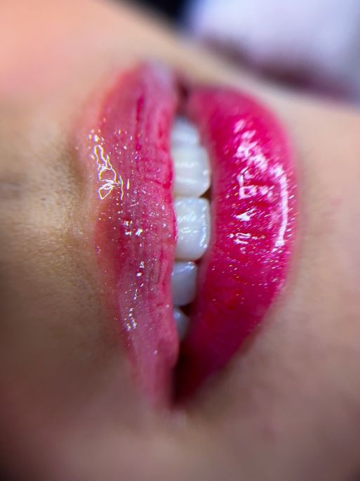 Spa Labial